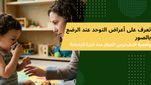 أعراض التوحد عند الرضع بالصور