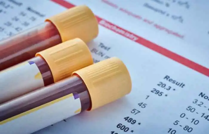 What-is-the-best-test-for-memory-loss